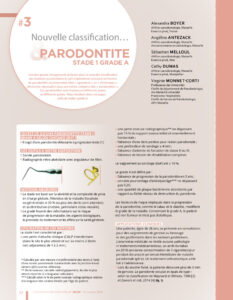 thumbnail of Nouvelle classification des maladies parodontales et parodontite de Stade I grade A