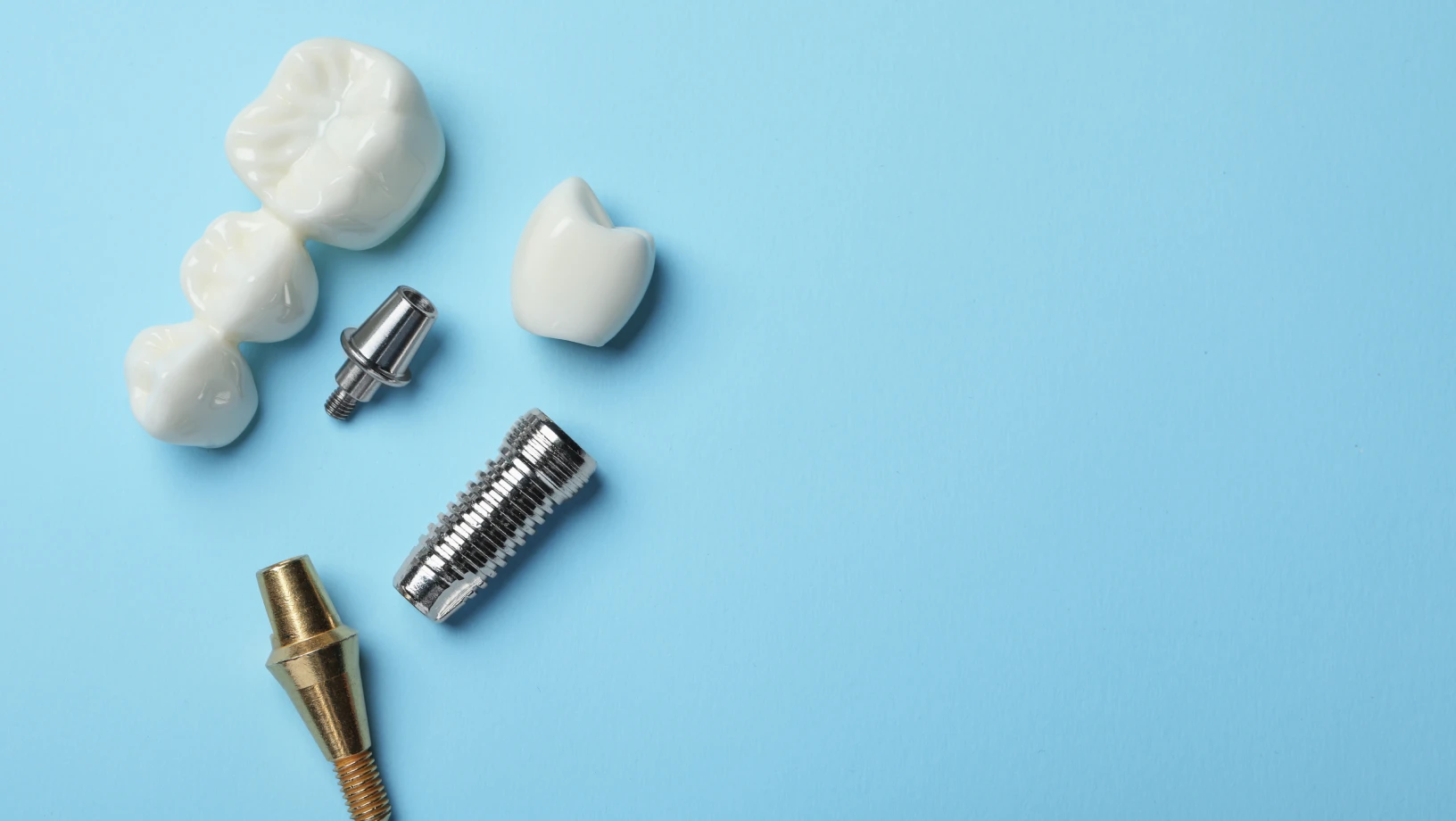 Implant dentaire ou appareil amovible ?